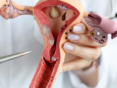 An anatomical model of a woman's reproductive system.