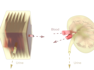 An illustration of an artificial kidney