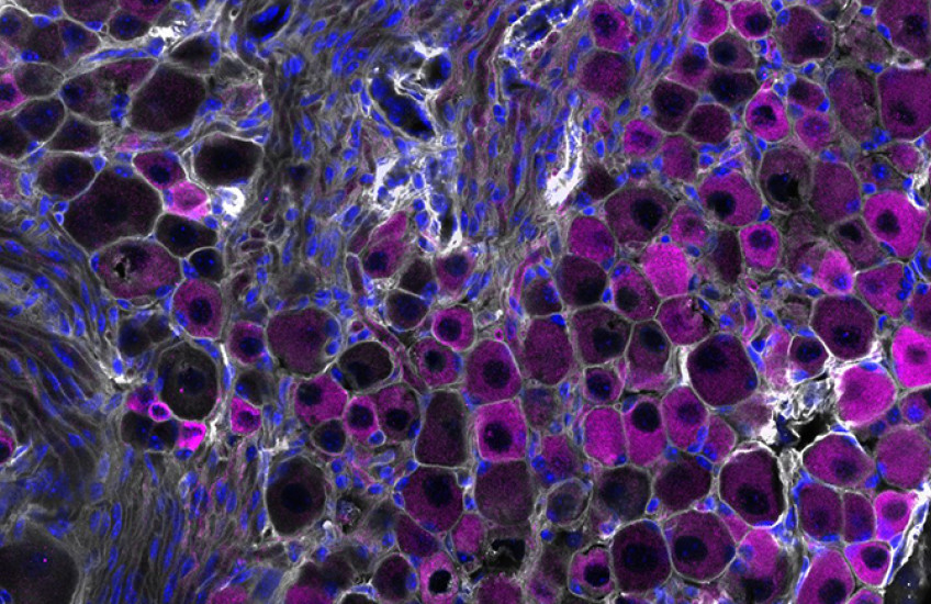 Purple and blue clusters of mouse vagus nerve sensory cells.